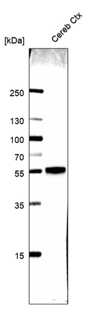 Western blot analysis in human cerebral cortex tissue.
