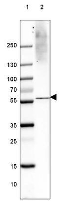 Lane 1: Marker [kDa] 250, 130, 100, 70, 55, 35, 25, 15, 10_br/_Lane 2: Human Cerebral Cortex tissue