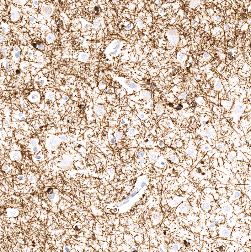 Anti-CNP Recombinant Antibody