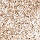 Anti-CNP Recombinant Antibody