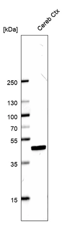 Western blot analysis in human cerebral cortex tissue.