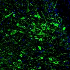Immunofluorescence staining of rat midbrain shows strong positivity in serotonin neurons in the dorsal raphe nucleus.