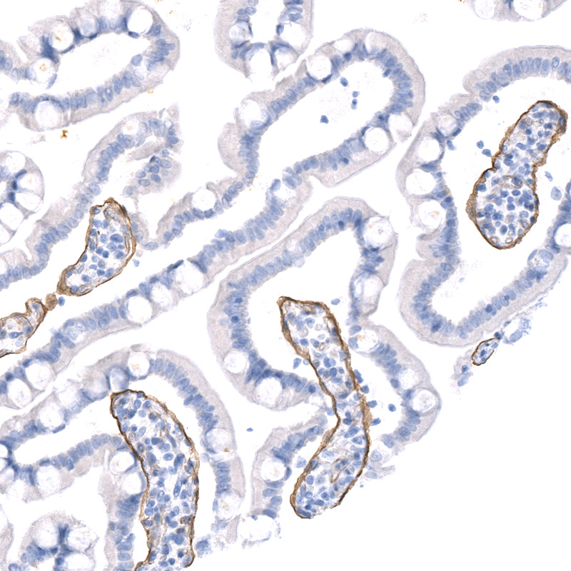 Anti-LAMA5 Recombinant Antibody