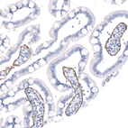 Anti-LAMA5 Recombinant Antibody