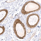 Immunohistochemical staining of human fallopian tube shows strong membranous positivity in smooth muscle cells of blood vessels.