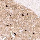 Anti-CHAT Recombinant Antibody