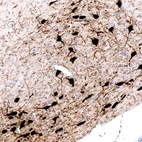 Immunohistochemical staining of rat basal forebrain shows strong cytoplasmic immunoreactivity in large cholinergic neurons.