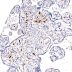 Immunohistochemical staining of human placenta shows moderate positivity in a subset of cells.
