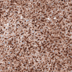 Immunohistochemical staining of human liver shows strong granular cytoplasmic positivity in hepatocytes.