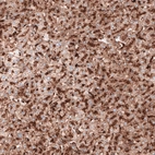 Immunohistochemical staining of human liver shows strong granular cytoplasmic positivity in hepatocytes.