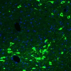 Immunofluorescence staining of rat brain shows strong cytoplasmic positivity in acetylcholine neurons in the basal forebrain.