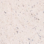 Immunohistochemical staining of human cerebral cortex shows positivity in cholinergic neural fibers.
