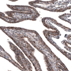 Immunohistochemical staining of human fallopian tube shows strong granular cytoplasmic positivity in glandular cells.