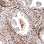 Immunohistochemical staining of human prostate shows moderate to strong membranous positivity in smooth muscle cells.