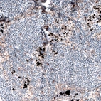 Immunohistochemical staining of human lymph node shows no positivity in non-germinal center cells as expected.