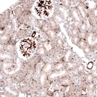 Immunohistochemical staining of rat kidney shows strong membranous positivity in cells in glomeruli.