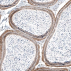 Immunohistochemical staining of mouse epididymis shows moderate to strong membranous positivity in smooth muscle cells.