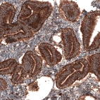 Immunohistochemical staining of human endometrium shows strong granular cytoplasmic positivity in glandular cells.