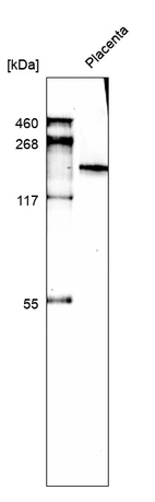 Western blot analysis in human placenta tissue.