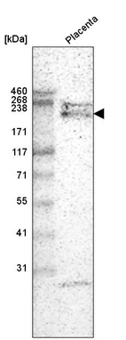 Western blot analysis in human placenta tissue.
