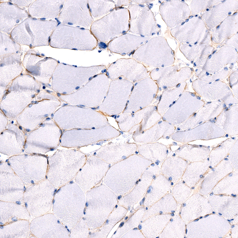 Anti-LAMA2 Recombinant Antibody