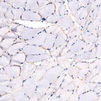 Anti-LAMA2 Recombinant Antibody