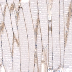 Immunohistochemical staining of rat skeletal muscle shows moderate membranous positivity in myocytes.