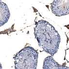 Immunohistochemical staining of mouse testis shows moderate positivity in basement membrane of seminiferous ducts and Leydig cells.