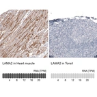 Immunohistochemistry analysis in human heart muscle and tonsil tissues using AMAb91166 antibody. Corresponding LAMA2 RNA-seq data are presented for the same tissues.