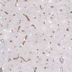 Immunohistochemical staining of human cerebral cortex shows moderate positivity in blood vessels.