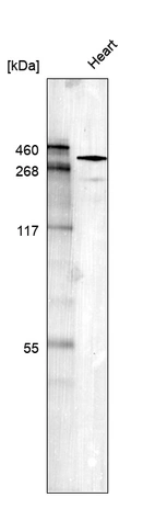 Western blot analysis in human heart tissue.