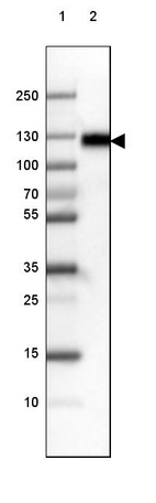 Lane 1: Marker [kDa] 250, 130, 100, 70, 55, 35, 25, 15, 10_br/_Lane 2: Human cell line RT-4