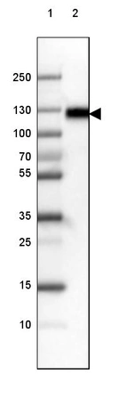 Lane 1: Marker [kDa] 250, 130, 100, 70, 55, 35, 25, 15, 10_br/_Lane 2: Human cell line RT-4