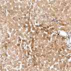 Anti-PPIB Recombinant Antibody