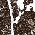 Immunohistochemical staining of human pancreas shows strong cytoplasmic positivity in exocrine glandular cells.