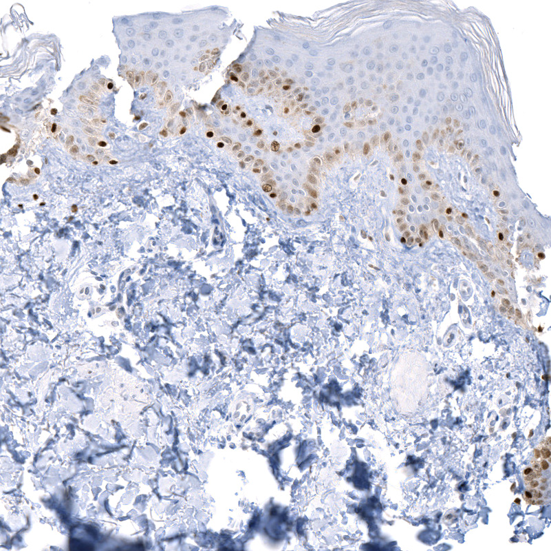 Anti-SOX10 Recombinant Antibody
