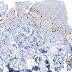 Anti-SOX10 Recombinant Antibody