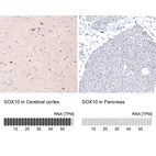 Immunohistochemistry analysis in human cerebral cortex and pancreas tissues using AMAb91297 antibody. Corresponding SOX10 RNA-seq data are presented for the same tissues.