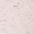 Immunohistochemical staining of human cerebral cortex shows strong nuclear positivity in glial cells (oligodendrocytes).