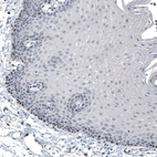 Immunohistochemical staining of human squamous epithelium shows strong nuclear positivity in stratum basale cells.