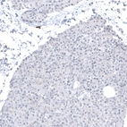 Immunohistochemical staining of human pancreas shows no positivity in exocrine glandular cells as expected.