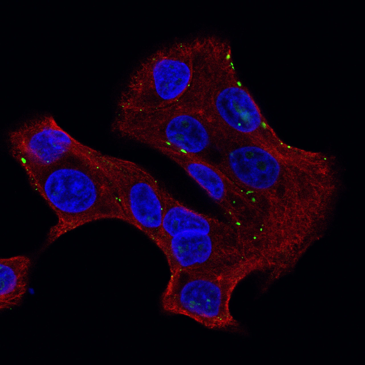 Anti-GJB6 Recombinant Antibody