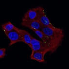 Anti-GJB6 Recombinant Antibody