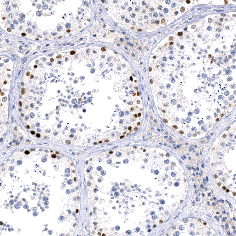 Anti-PRAME Recombinant Antibody