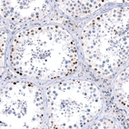 Anti-PRAME Recombinant Antibody