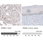 Immunohistochemistry analysis in human testis and cervix, uterine tissues using AMAb91330 antibody. Corresponding PRAME RNA-seq data are presented for the same tissues.