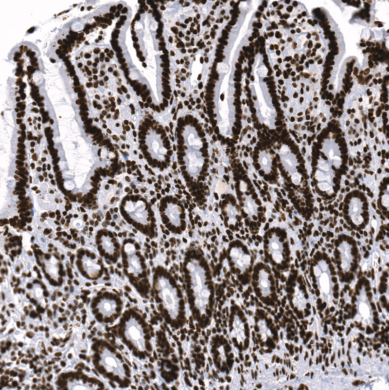 Anti-H2AFY Recombinant Antibody