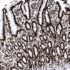 Anti-H2AFY Recombinant Antibody
