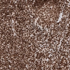Immunohistochemical staining of human tonsil shows strong nuclear immunoreactivity in lymphoid cells.