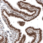 Immunohistochemical staining of human fallopian tube shows strong nuclear positivity in glandular and stromal cells.